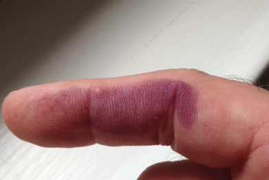 finger-ninhydrin